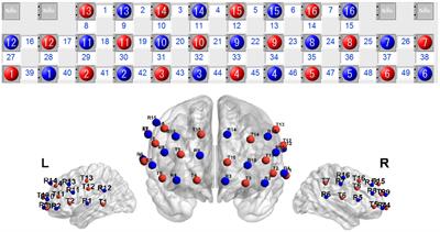 The neural mechanisms underlying the processing of consonant, vowel and tone during Chinese typing: an fNIRS study